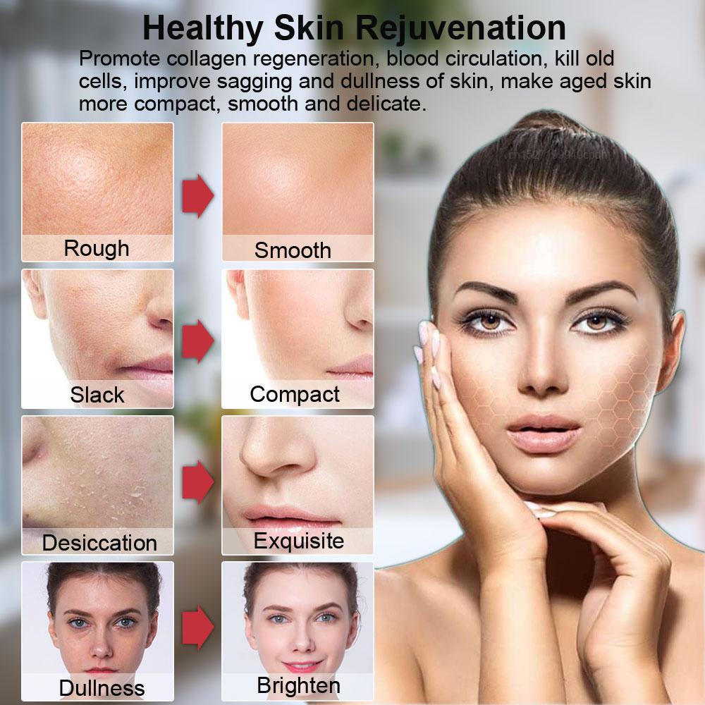 Hifu Face Lifting Facial Massage EMS Facial Microcurrent Skin Rejuvenation Anti-aging Facial Lifting Massager Mini Hifu Machine
