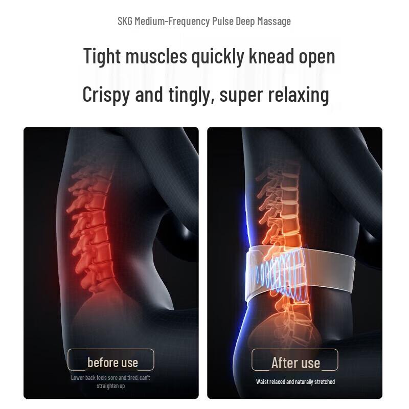 SKG W7 II Luxury Mid-Frequency Pulse Waist Massager CN Plug (adapter Included)