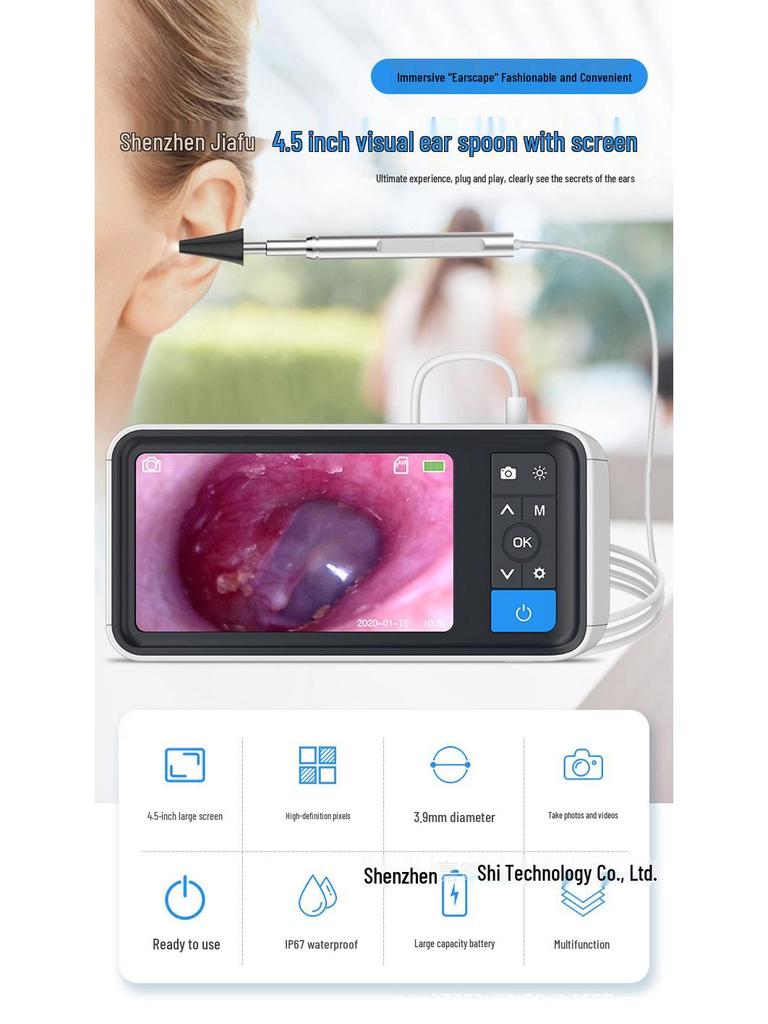 אוטוסקופ ויזואלי HD ואנדוסקופ להסרת שעוות אוזניים בגודל 4.5 אינץ'
