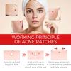 Acne Pimple Patch Repair Facial Acne Acne Cover Acne Smooth Skin Care Pimple Patch Mild Non-Irritating Skin