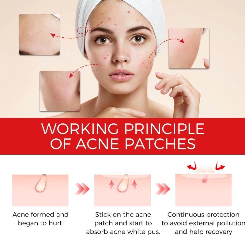 Acne Pimple Patch Repair Facial Acne Acne Cover Acne Smooth Skin Care Pimple Patch Mild Non-Irritating Skin