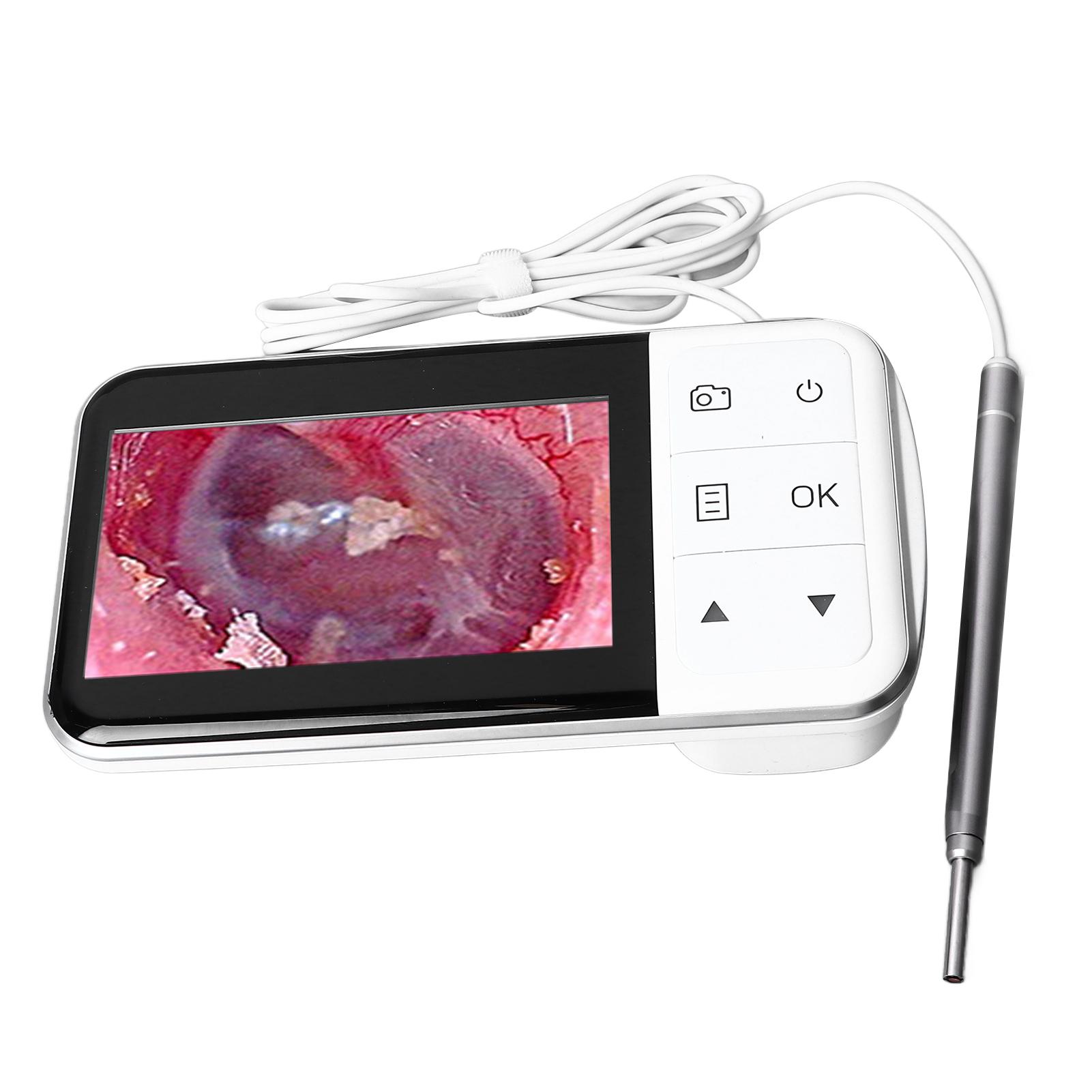 

Цифровой отоскоп, визуальная удобная ушная камера, инструмент для удаления ушной серы с дисплеем 4,5 дюйма