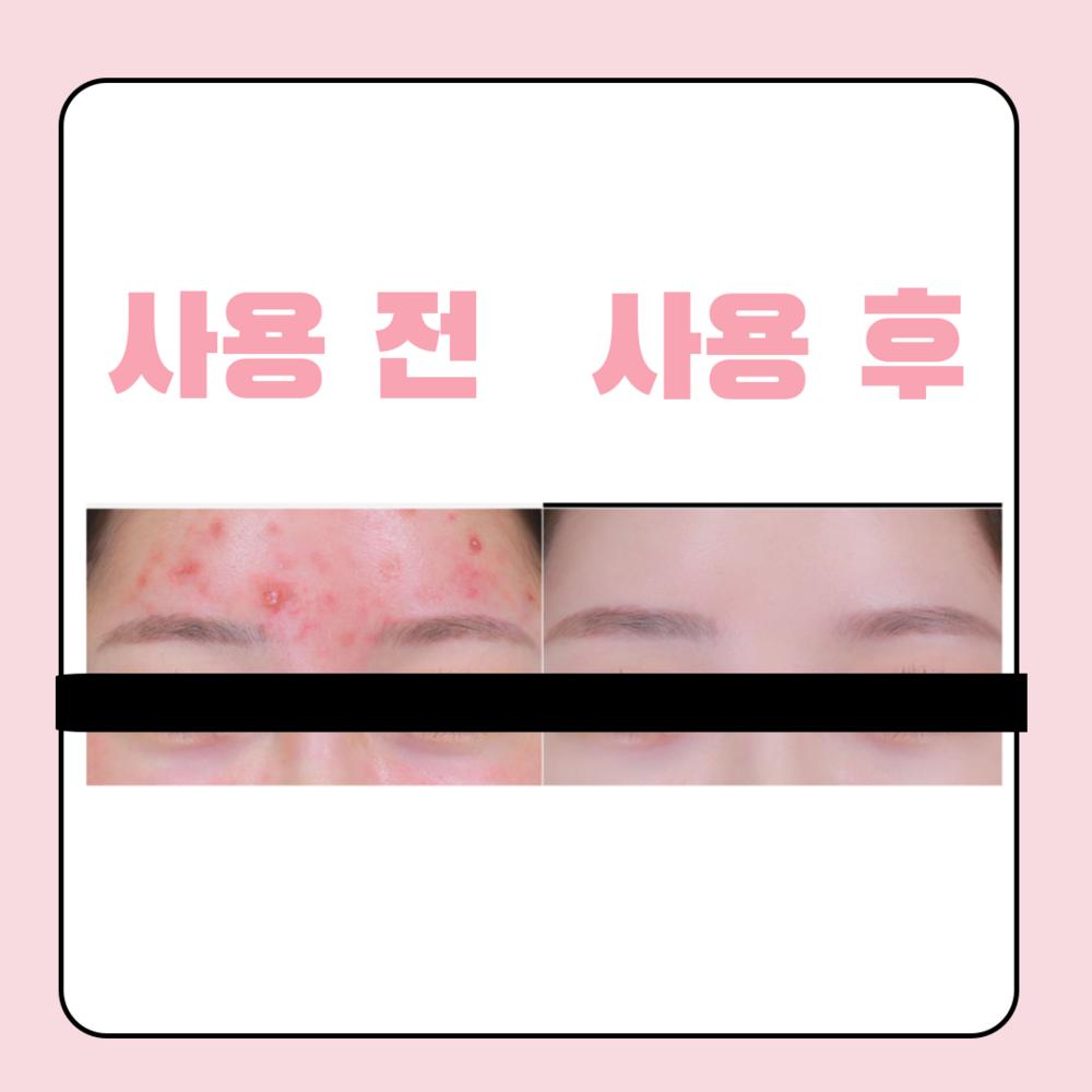 Perfect coverage of dark circles/blemishes/pores/scars/trouble with Delieverly Cover Dream Concealer (single item 1+1 3+1)