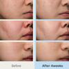 Dr. Althea 345 Relief Cream 50ml Set (+10ml*2ea+Tube Ringer)