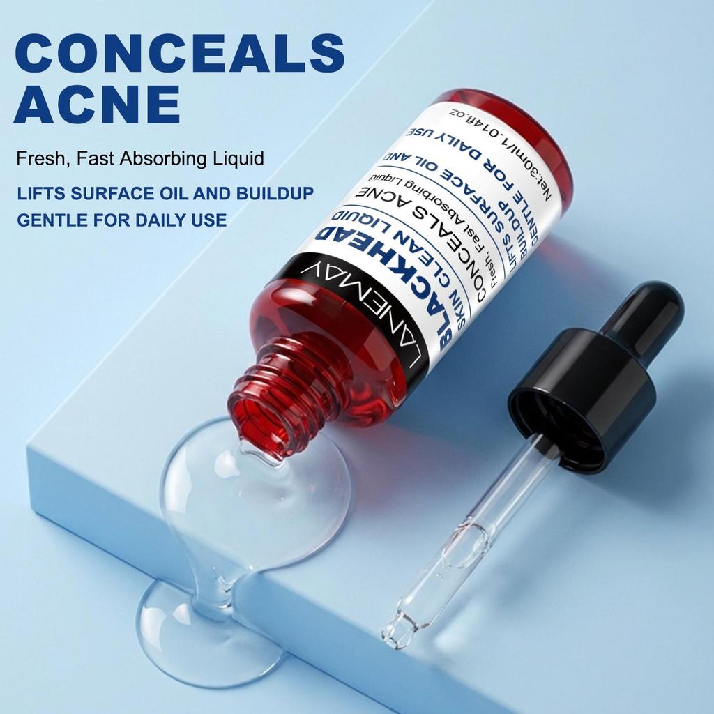 Blackhead Skin Clean Liquid-Lifts Surface Oil And Buildup-Clean Face And Conceals Acne-Gentle For Daily Use, 30ml
