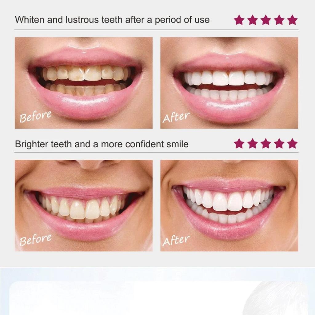 Suitable for daily use with a mild formula to clean the surface of teeth, helping to maintain teeth shine and oral comfort