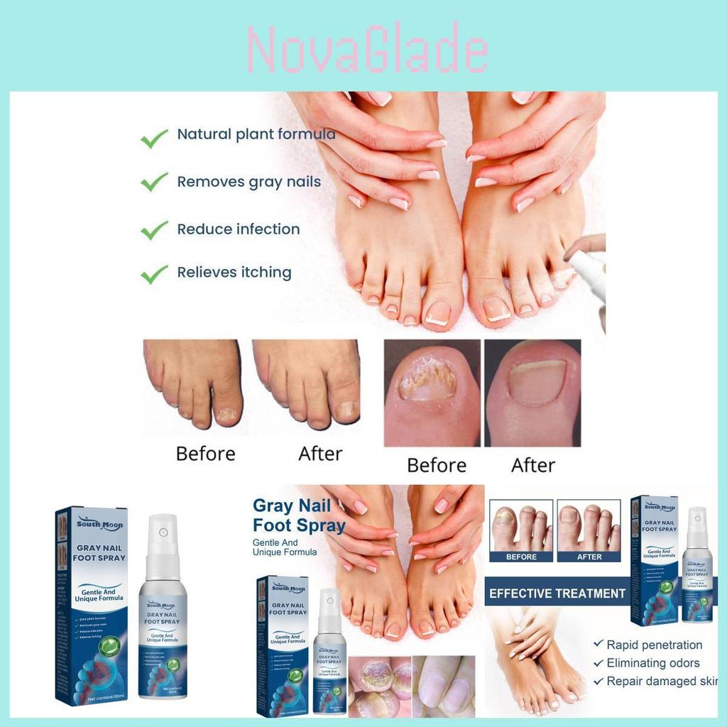 South Moon Gray Nail Repair Spray Nourishing Moisturizing Treatment For Dry And Odorous Nails