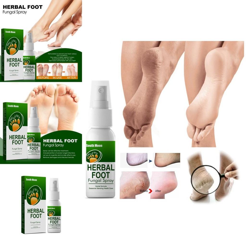 South Moon Herbal Foot Spray For Itchy Feet With Odor Removal And Skin Care 30ml