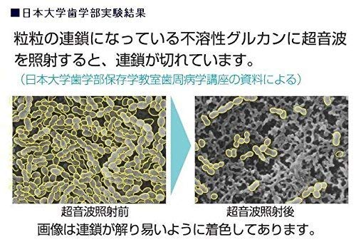 SMILEX Ultrasonic Electric Toothbrush AU-300D 1.6MHz