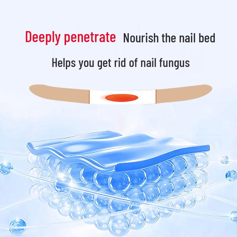 Guo Yi Onychomycosis Patch: Nail & Toe Care for Gray Nails