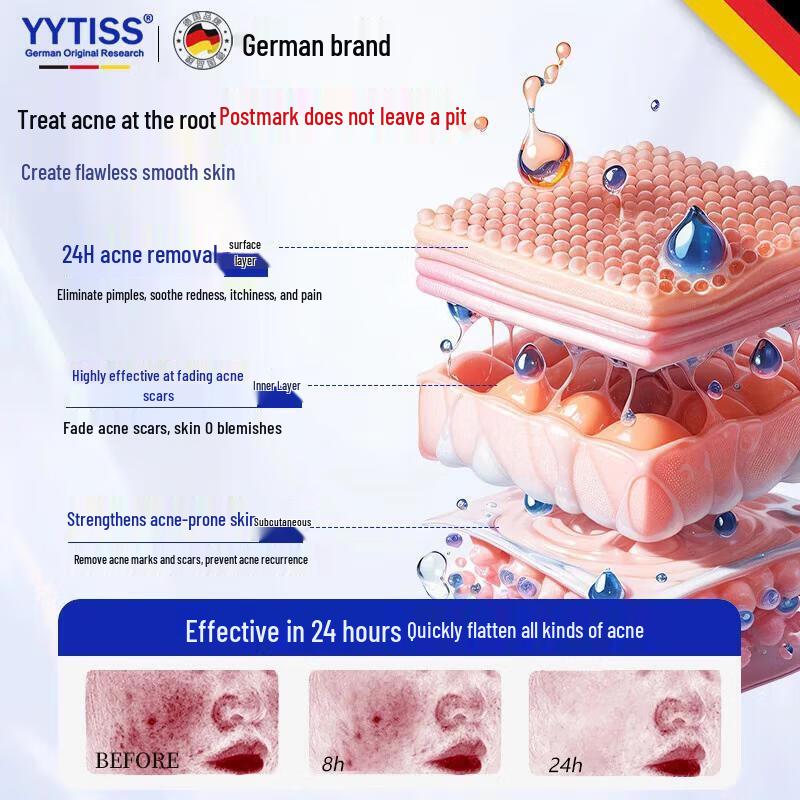 YYTISS Acne Treatment Cream