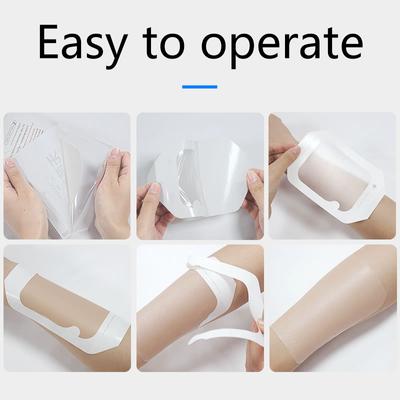 10 stuks Transparant Filmverband Waterdicht Wondverband Zelfklevende Pleisters Post-Infusie Verblijfskatheter Fixatiepasta