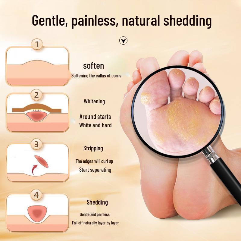 Corn Plaster & Ointment for Foot Calluses: Qingjianling Cream & Jiyoukang Patch