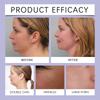 Wrinkle Firming Cream Lightens Wrinkles And Tightens Skin, Refines Pores, And Deeply Nourishes Skin Cream