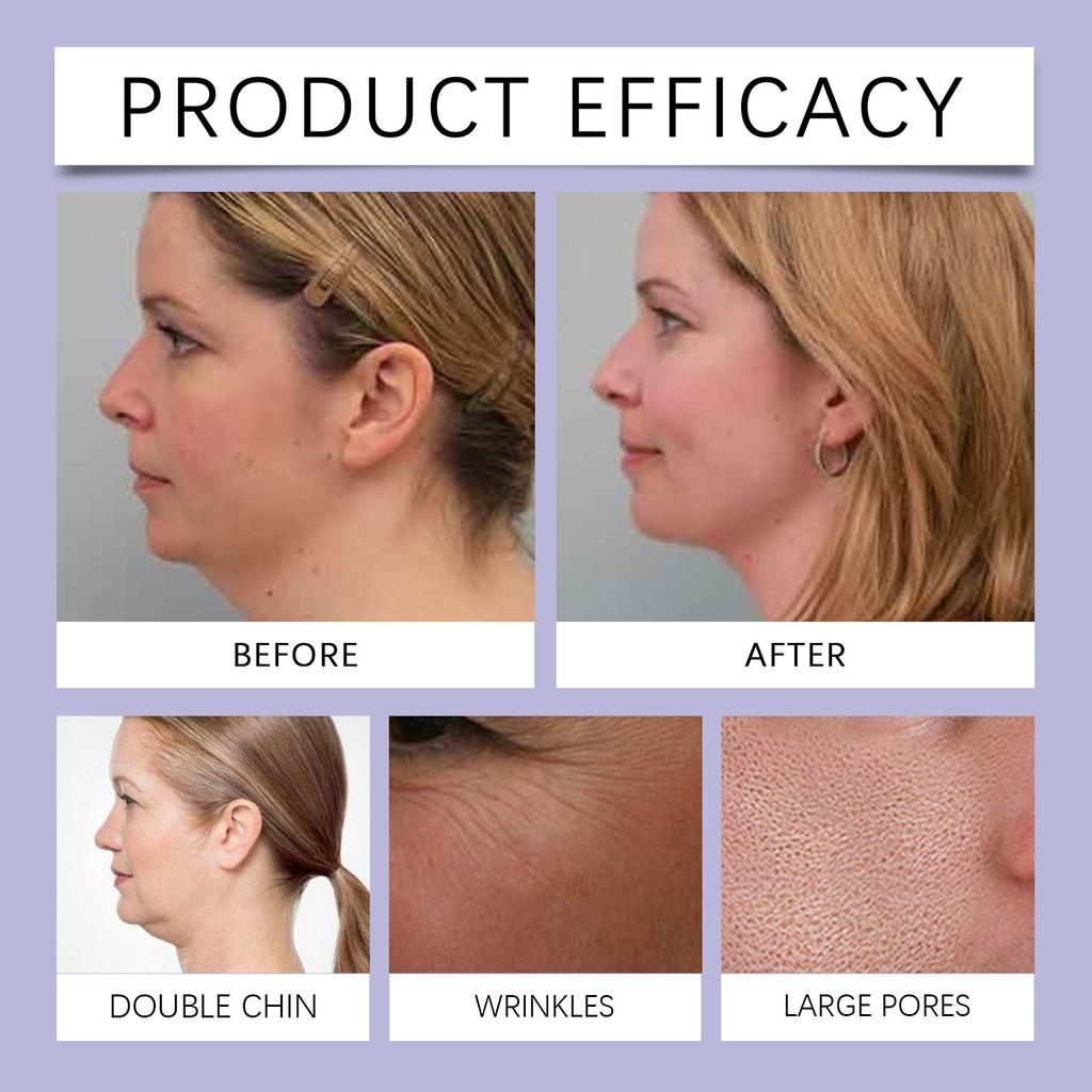 Wrinkle Firming Cream Lightens Wrinkles And Tightens Skin, Refines Pores, And Deeply Nourishes Skin Cream