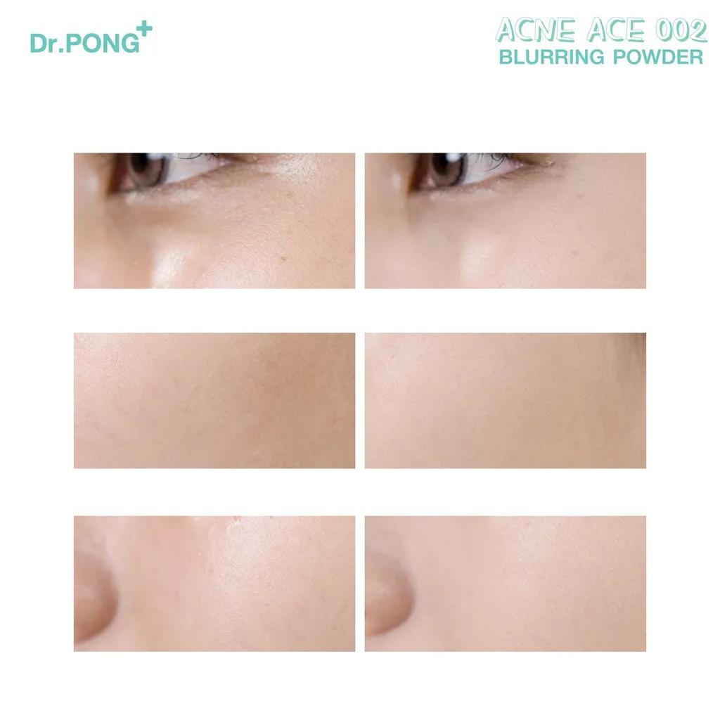 Dr.PONG+ ACNE ACE 002 Puder rozmywający z podkładem, niacynamid, cynk PCA, olejek z drzewa herbacianego, kwas traneksamowy, witamina E, 10 g.