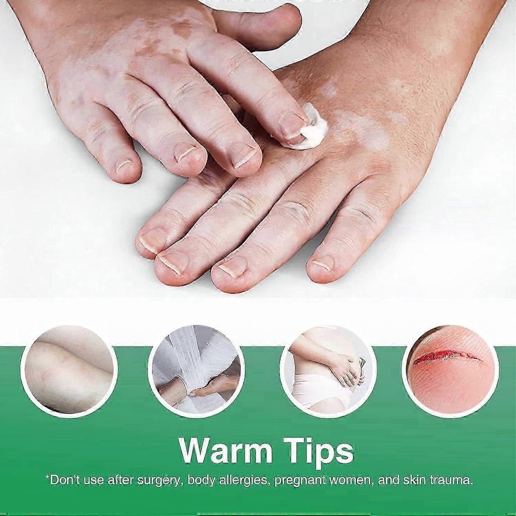 Vitiligo Cream, Anti-Vitiligo Cream, Natural Vitiligo Treatments Cream for Skin, Reduce White Spots and Improve Skin Pigmentation, 20g