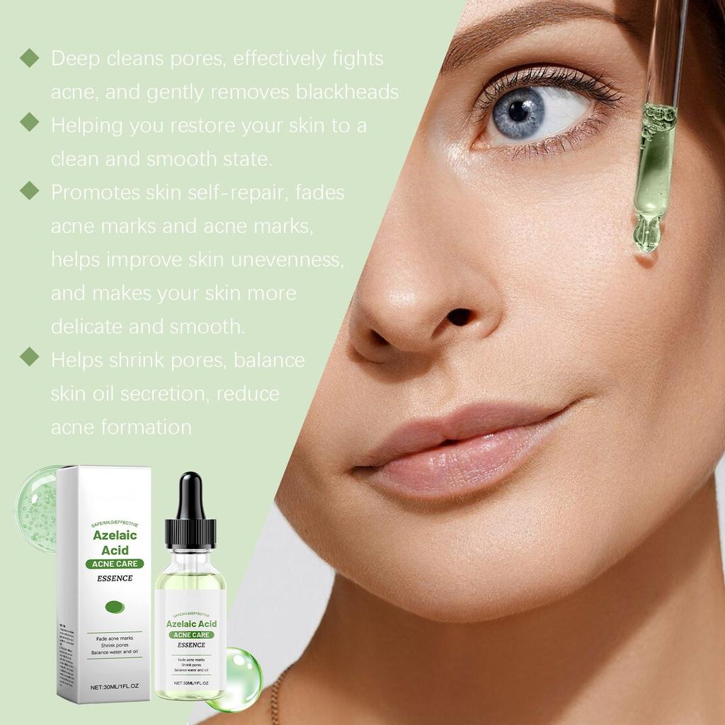 Azelaic Facial Serum Moisturizes And Improves The Skin For Blackheads And Acne 30ml