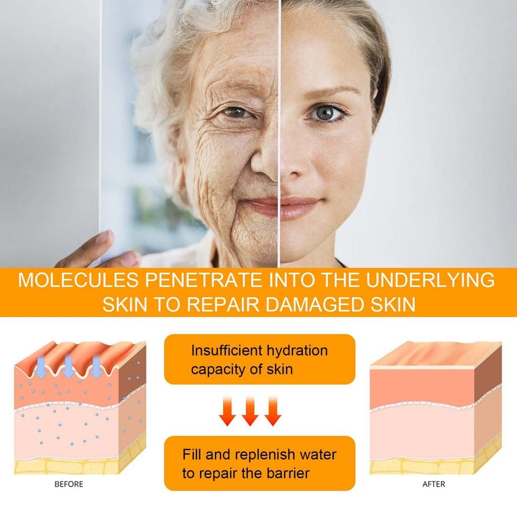 Hoygi 5d Peptide Anti-wrinkle Eye Repair Cream For Smooth And Hydrated Skin