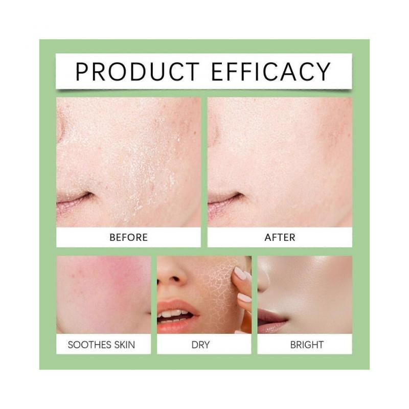 Anua Azelaic Acid 10 Hyaluron Redness Soothing Serum, Facial Serum for Sensitive Skin, Hyaluronic Acid, Niacinamide, Spot Care