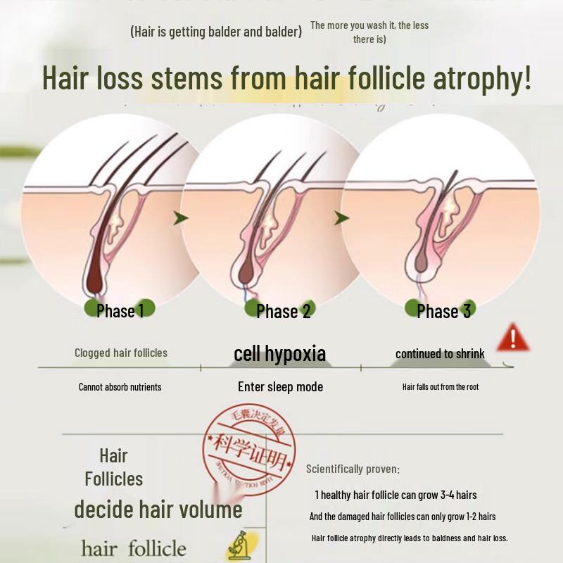 Tong Ren Tang Anti-Haarausfall & Haarwachstum Shampoo mit Ingwer