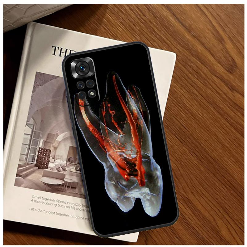 Human Tooth Anatomy Case For Xiaomi Redmi Note 13 11 10 9 8 12 Pro Plus 12S 11S 10S 9S 10A 9C 10C 12C 13C Funda