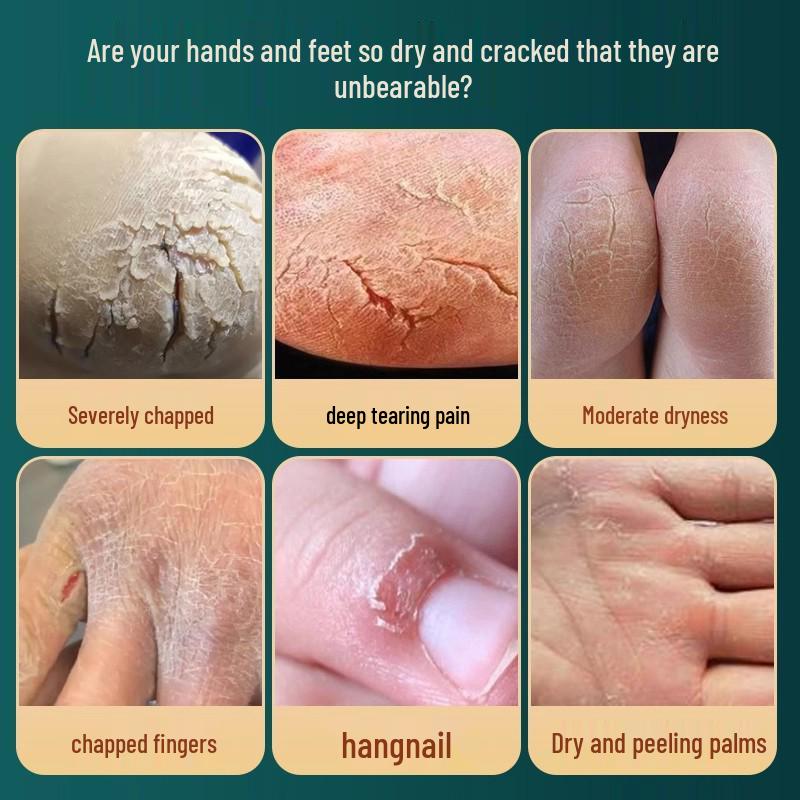 

Пропозиція для новачків: Крем для п ят і рук з кінською олією для потрісканої, сухої шкіри 2 boxes (Buy 1 Get 1) - Daily Care