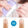 Smart Nail Clippers, Electric Nail Clippers For The Elderly, Electric Nail Clippers, Three In One Automatic Nail Clippers