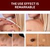 Tags & Moles Remover, WipeOff Tags & Moles Remover, WipeOff Remover 3ML