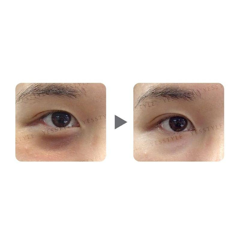 Zino - Dark Circle Removal Golden Eye Mask