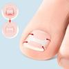 Ingrown Toenail Corrector Patches,Ingrown Toenail Treatments Tool Foot Care,10pcs Ingrown Toenail Corrector Strips