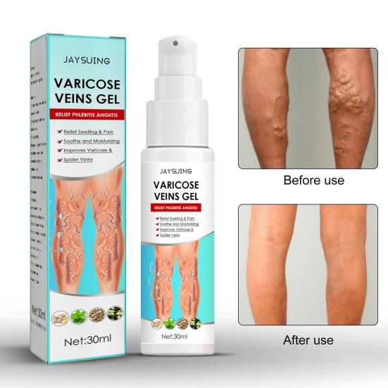 

30 мл крем для вен, натуральный, уменьшает боль, уход за кожей, личный гель для облегчения воспаления вен для тела