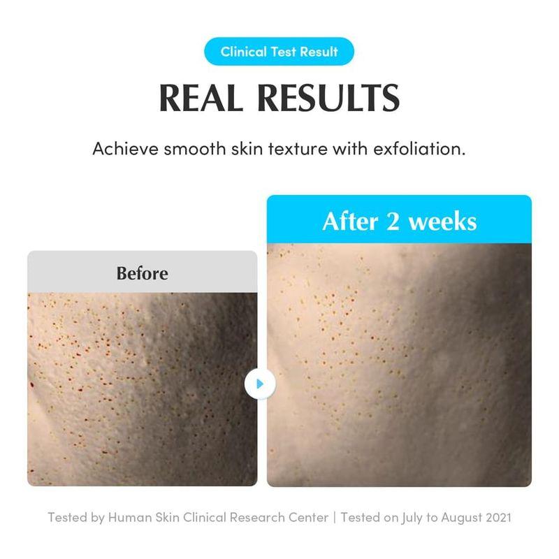 Eqqualberry Swimming Pool Daily Facial Toner 300ml Bundle Set