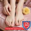 Bee Venom Nail Spray - Extra Strength Toenail and Fingernail Care Serum - Fast-Acting Formula for Fragile Abnormal Rough Fingers