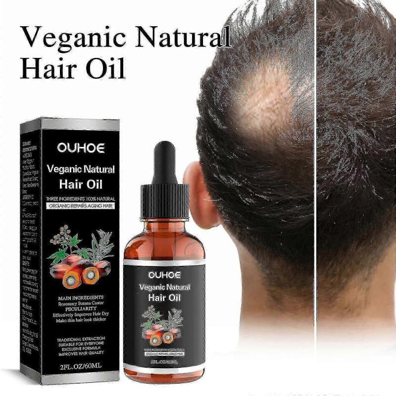 OUHOE dense hair mixed oil moisturizing and maintenance anti-loss strong hair fixation thick hair care essence oil | |-3648633399688