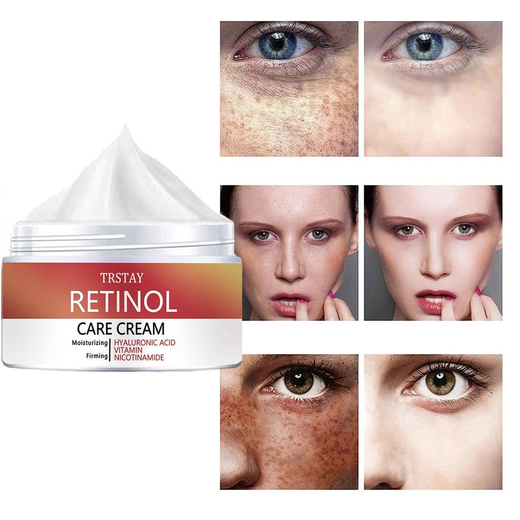 Whitening and moisturizing cream for freckle correction, reducing aging, anti-oxidation, nourishing , moisturizing and hydrating skincare cream