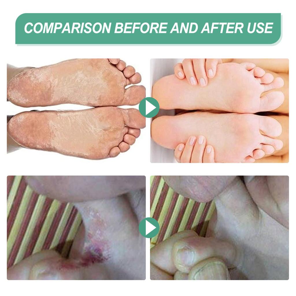 South Moon Odor-eliminating Foot Spray Refreshes And Moisturizes 45ml Boxed