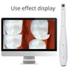 Dental Split Oral Viewer Intraoral Camera 10.0 Mega Pixel HD WiFi 6 LED Dental Equipment Oral Inspection Tool