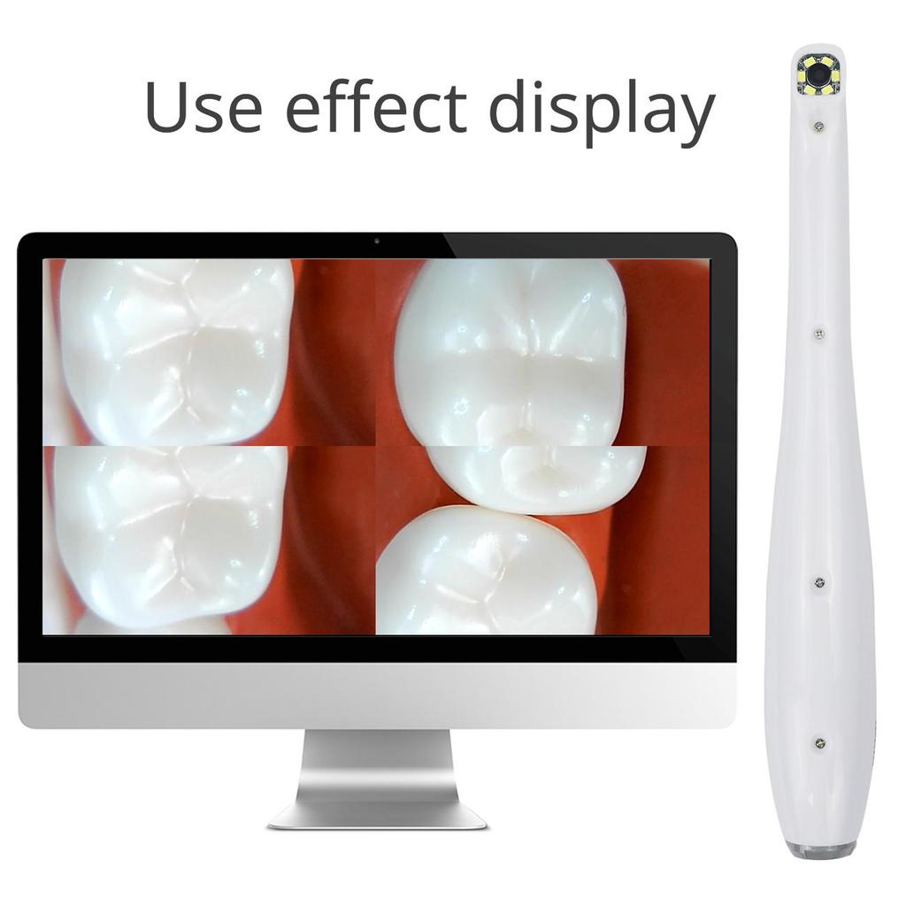 Dental Split Oral Viewer Intraoral Camera 10.0 Mega Pixel HD WiFi 6 LED Dental Equipment Oral Inspection Tool
