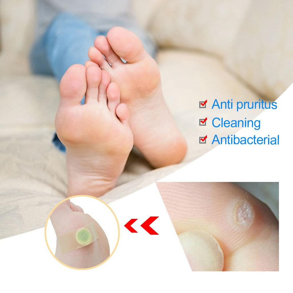 Corns Patch Reduces Corns, Calluses, Spines, Plantar s, Corns Ointment, Corns Ointment, Toe Corns Remover, Foot Calluses Health Patch.