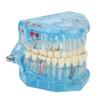 Zubní patologický model Jasný výukový odnímatelný model zobrazení zubních zubů Modrý Průhledný