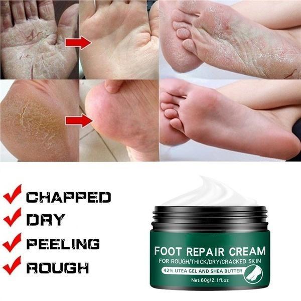 La più recente crema idratante riparatrice per la pelle delle mani e dei piedi anti-screpolature per piedi screpolati, secchi e screpolati, crema per i piedi riparatrice del tallone