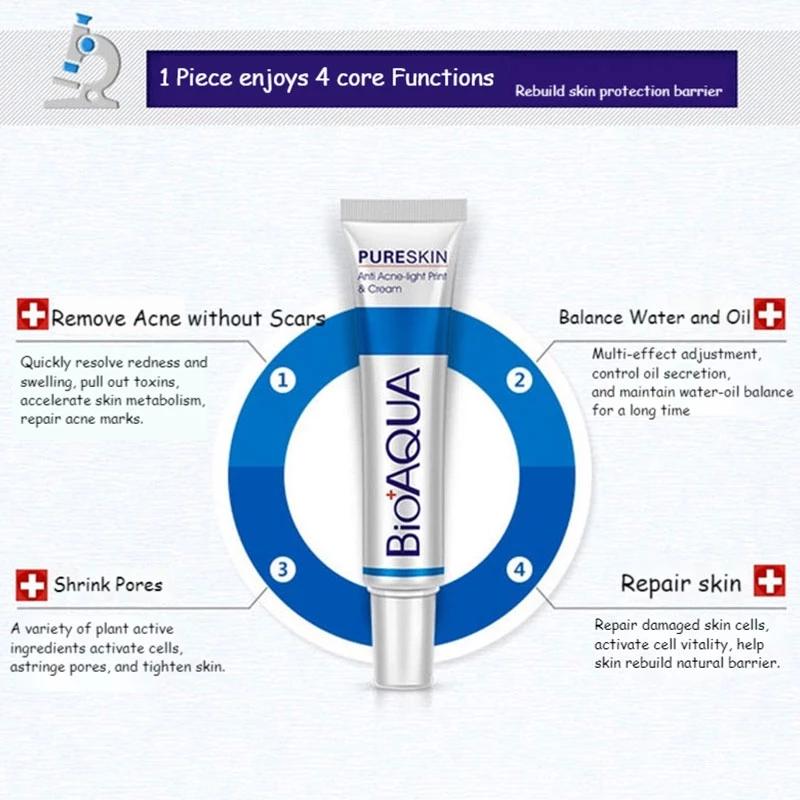 BIOAQUA Creme zur Entfernung von Aknenarben, Gel, Anti-Akne-Behandlung, Gesichtsaufhellungscreme, Ölkontrolle, Verblassen dunkler Flecken, Hautpflege