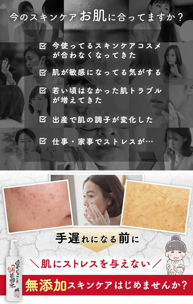 special beauty water Moisturizing mist lotion Moisturizing Sensitive skin Lotion Beauty essence Ai-chan's [3-bottle set] Additive-free