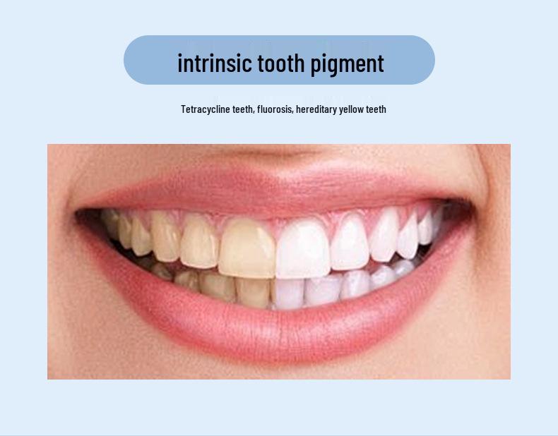 Electric U-Shaped Toothbrush for Adults - Automatic Whitening & Cleaning for Home Use, Students & Couples