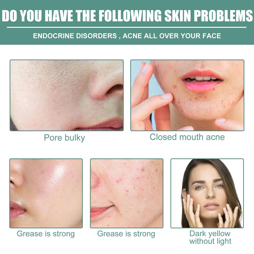 New Advanced Deep Skin Care, Facial Skin Daily Lotion, Face Lotion, Pore Lift Face Lotion For All Skin Types 30ml