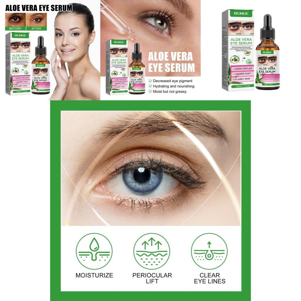 Ouhoe Eye Care Essence Reduces Fine Lines Dark Circles Brightens Dull Skin Hydrating Soft Eye Area 30ml