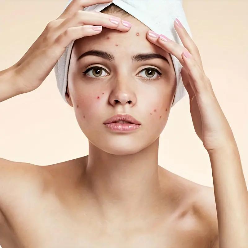 50/100/150/200 ks Nástroj na odstranění skvrn na černé tečky, ultra jemná jehla Snadné odstranění akné Akné Nástroje z nerezové oceli, čisté a hygienické pro kosmetický salon