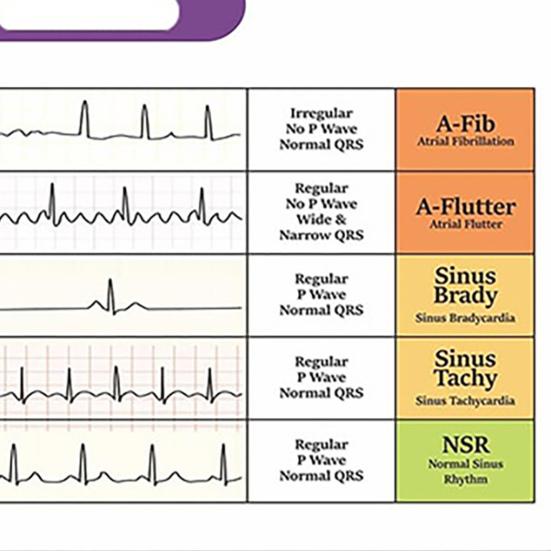Yousheng EKG Rhythm Interpretation Card Portable Reference Badge Card Electrocardiogram Rapid Interpretation Guide Horizontal Vertical Layout Cheat