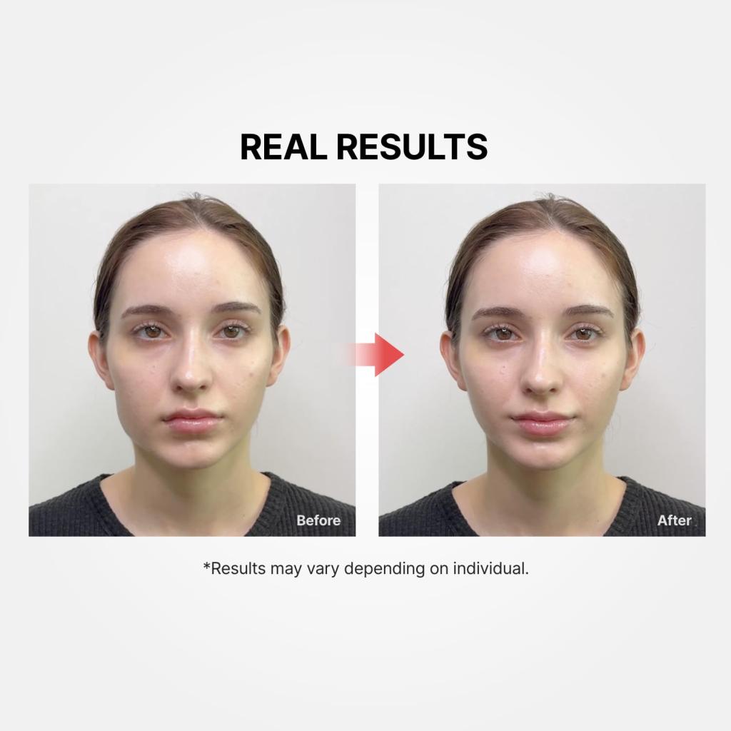 Meditherapy Shumage Gold Seal Lifting Cream+EMS Device